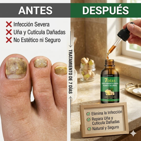 7 Días Elimina Hongos X2 Und — Tratamiento antifúngico natural para uñas